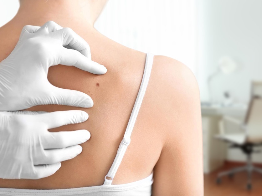 Kožní ordinace - MUDr. Simona Sládková